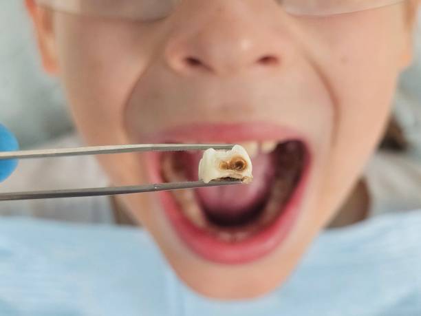 Best Emergency Treatment for Toothache in Anthony, KS