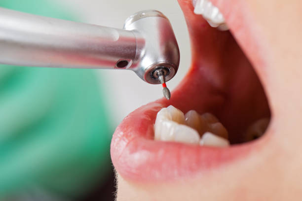 Best Same-Day Emergency Dentist in Anthony, KS